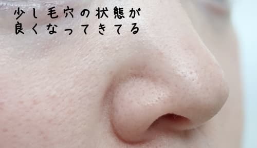 1週間後の経過の写真がコレです