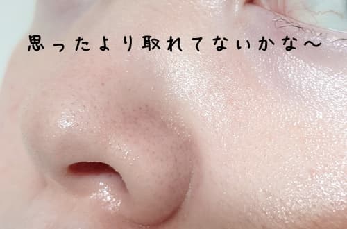 思ったより毛穴はキレイになってませんでした