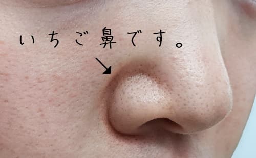 私はいちご鼻に悩んでいるんですが、朝のすっぴん肌の状況はこんな感じです。