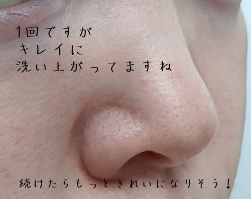 DUOいちごのいちご鼻への効果は？