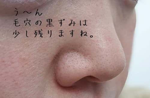ママコスメクレンジングバームを１回使ってみての毛穴の変化はこんな感じです。