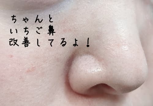 いちご鼻への効果ですが、これはすごく良かった