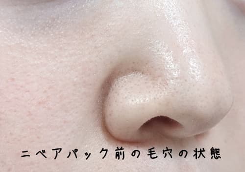 ニベアパック前のいちご鼻の状態を確認します