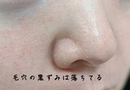 ケアの黒ずみは、洗い上がりの段階だとなくなってますね。