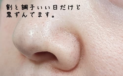 今現在の毛穴の黒ずみの状態