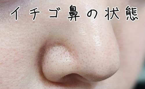 使用前のいちご鼻の状態をさらしておきます