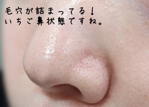 今日のメイクをする前の、鼻の黒ずみの状態がコレです。