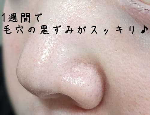 初めのいちご鼻の状態に比べると、すごくきれいな状態になりました。
