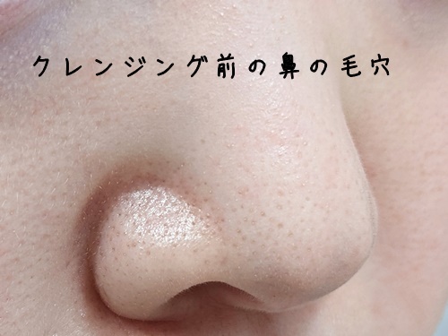 まずはクレンジングバーム使用前の鼻の毛穴をチャックしておきます。