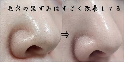 バニラコのクレンジングバーム鼻のビフォーアフター