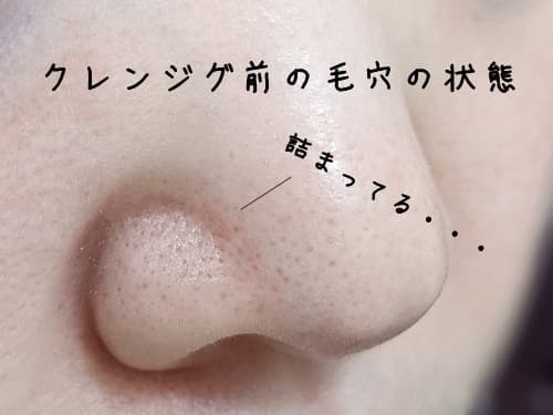 まずは、クレンジングバーム前の毛穴を確認しておきます。