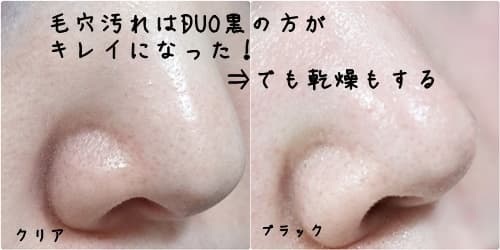 DUOクリア・黒の毛穴への効果の違いは？