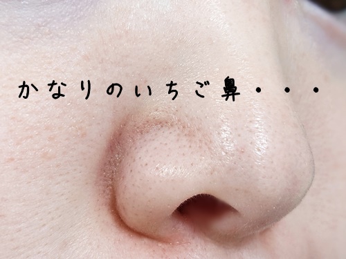 毛穴の黒ずみ・角栓への効果は？