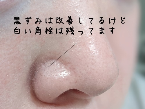 気になる、洗い上がりの毛穴の状態は、こんな感じです。