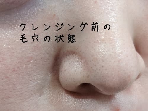 毛穴の黒ずみ・角栓への効果は?