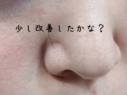 毛穴は少し改善した