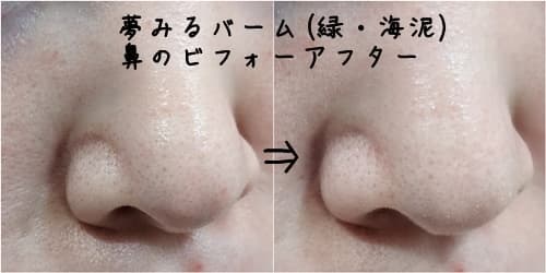 夢みるバームのクレンジングしてみた、ビフォーアフター