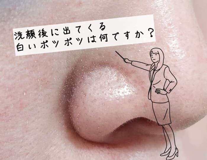 洗顔後の毛穴の白いポツポツって何？放置したらやばい？